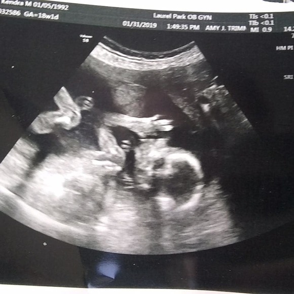 Meet your Posher, Joey - Picture 1 of 1